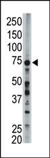 The anti-FACL6 Pab (Cat. #AP2537b) is used in Western blot to detect FACL6 in mouse liver tissue lysate.