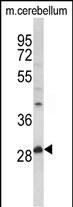 Western blot analysis of hPPT1-C46 (Cat. #AP2538a) in mouse cerebellum tissue lysates (35ug/lane).PPT1 (arrow) was detected using the purified Pab.