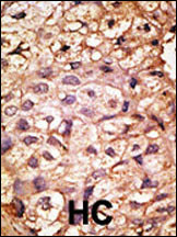 IHC-P - ACE2 (NCOVID / SARS Receptor) Antibody (N-term) AP6020b