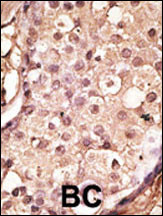 IHC-P - ACE2 (NCOVID / SARS Receptor) Antibody (Center) AP6020d
