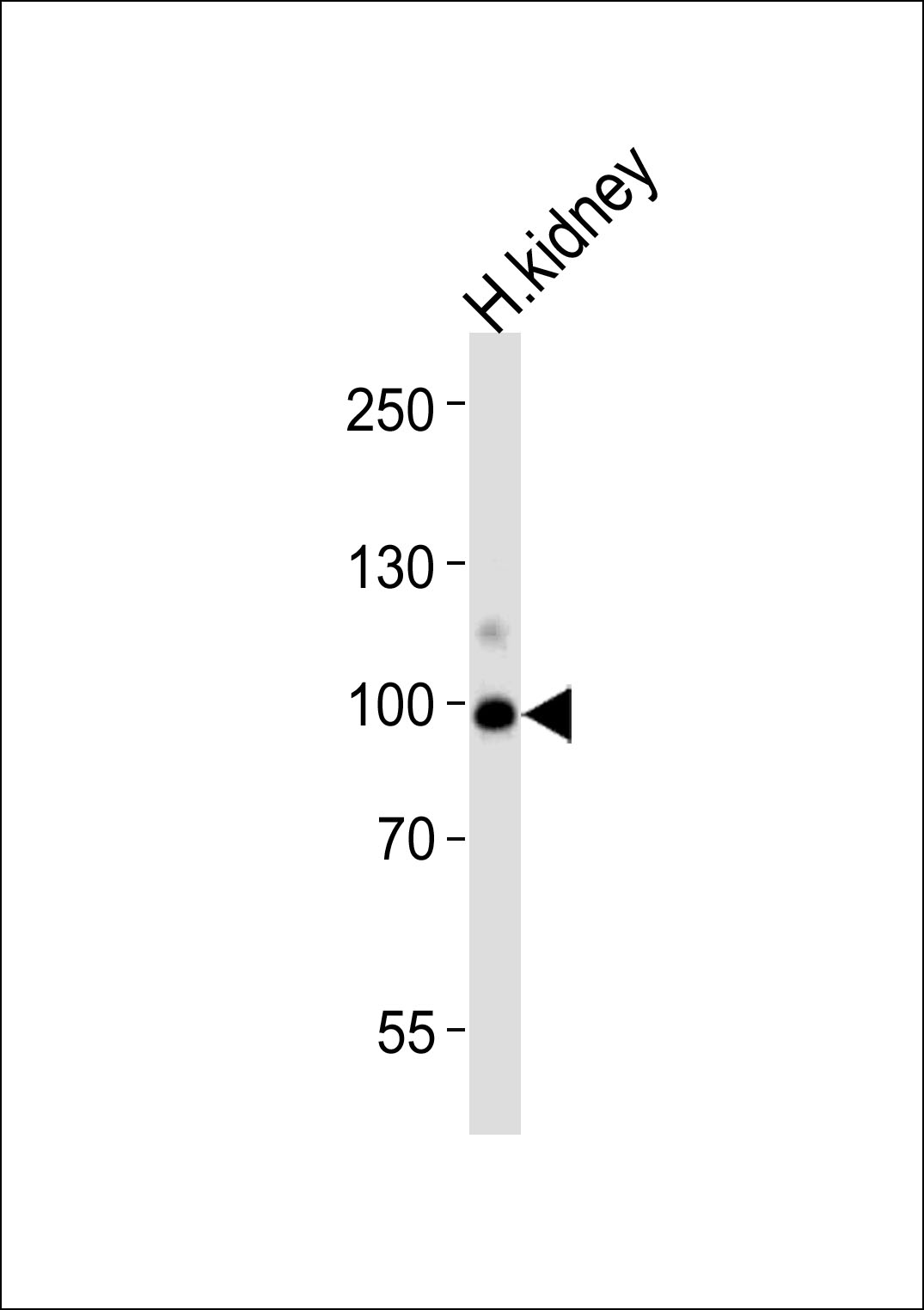 Western blot analysis of lysate from human kidney tissue lysate, using ACE2(SARS-R) Antibody (S155)(Cat. #AP6020d). AP6020d was diluted at 1:1000 at each lane. A goat anti-rabbit IgG H&L(HRP) at 1:5000 dilution was used as the secondary antibody. Lysate at 35ug per lane.