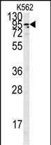 WB - ACE2 (NCOVID/SARS Receptor) Antibody (C-term) AP6020f