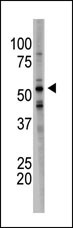 The anti-BACE1B Ctr Pab (Cat. #AP6102a) is used in Western blot to detect BACE1B in mouse brain tissue lysate.