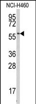 Western blot analysis of anti-BACE1C Antibody (Center) (Cat.#AP6103a) in NCI-H460 cell line lysates (35ug/lane). BACE1C(arrow) was detected using the purified Pab.