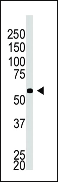 The anti-BACE2C C-term Pab (Cat. #AP6106a) is used in Western blot to detect BACE2C in A549 cell lysate.