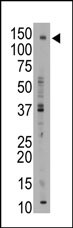 The anti-ABCB11 C-term Pab (Cat. #AP6110a) is used in Western blot to detect ABCB11 in mouse liver tissue lysate.