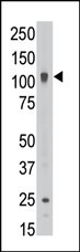 The anti-ABCB6 C-term Pab (Cat. #AP6113a) is used in Western blot to detect ABCB6 in HL60 cell lysate.