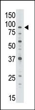 The anti-ABCB7 C-term Pab (Cat. #AP6114a) is used in Western blot to detect ABCB7 in Jurkat cell lysate.