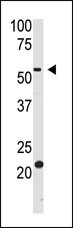 The anti-BACE2 Ctr Pab (Cat. #AP6121a) is used in Western blot to detect BACE2 in HL60 cell lysate.