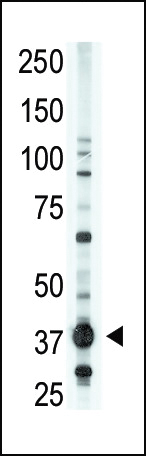 WB - EDG2 Antibody (N-term) AP6138a