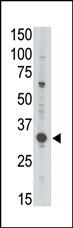 The anti-MAGEA3 (C-term) Antibody (Cat.#AP6165a) is used in Western blot to detect  MAGEA3 in Jurkat lysate.