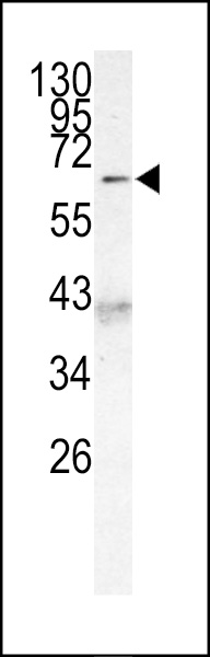 Western blot analysis of AF9 (MLLT3) Antibody (C-term K486) (Cat.#AP6190a) in 293 cell line lysates (35ug/lane). MLLT3(arrow) was detected using the purified Pab.