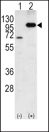Western blot analysis of APP (arrow) using rabbit polyclonal APP Antibody (C-term) (Cat. #AP6306b). 293 cell lysates (2 ug/lane) either nontransfected (Lane 1) or transiently transfected with the APP gene (Lane 2) (Origene Technologies).