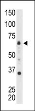 Anti-MTMR9 Antibody (Cat. #AP6808a) is used in Western blot to detect MTMR9 in mouse heart tissue lysate.