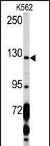 Western blot analysis of PDGFRA Antibody (C-term E1063) (Cat.# AP7666b) in K562 cell line lysates (35ug/lane). PDGFRA (arrow) was detected using the purified Pab.