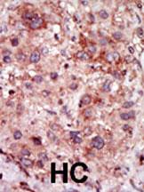 IHC-P - GAK Antibody (N-term) AP8061a