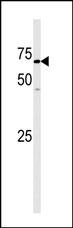 WB - GAK Antibody (N-term) AP8061a