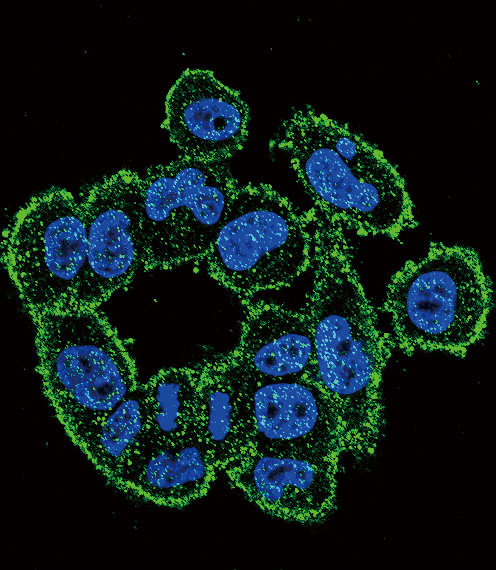 Confocal immunofluorescent analysis of Urokinase (PLAU) Antibody (C-term)(Cat#AP8161b) with A2058 cell followed by Alexa Fluor 488-conjugated goat anti-rabbit lgG (green). DAPI was used to stain the cell nuclear (blue).