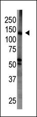 WB - BAIAP1 (MAGI1)Antibody (C-term) AP8173A