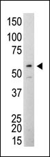 WB - SRC Antibody AM7718a
