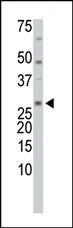 The anti-TrxL Pab (Cat. #AP1336b) is used in Western blot to detect TrxL in HL-60 cell lysate.