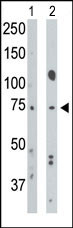 The anti-BMPR1A Pab (Cat. #AP2004e) is used in Western blot to detect BMPR1A in mouse muscle tissue lysate (Lane 1) and Hela cell lysate (Lane 2).