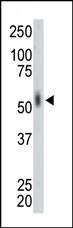 The anti-MKNK2 Pab (Cat. #AP7058a) is used in Western blot to detect MKNK2 in mouse lung tissue lysate.