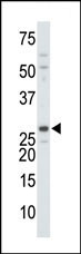 The anti-DTYMK Pab (Cat. #AP7060b) is used in Western blot to detect DTYMK in mouse colon tissue lysate.