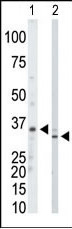 The anti-PRPS1/2/3 Pab (Cat. #AP7061a) is used in Western blot to detect PRPS1/2/3 in mouse kidney tissue lysate (Lane 1) and Hela cell lysate (Lane 2).