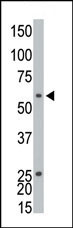 The anti-EKI1 Pab (Cat. #AP7068b) is used in Western blot to detect EKI1 in CHO cell lysate.