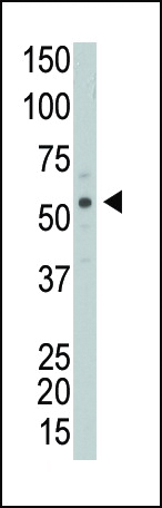 The anti-PRKCABP Pab (Cat. #AP7078a) is used in Western blot to detect PRKCABP in Y79 cell lysate.