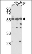 Western blot analysis of hPRKCABP-C300 (Cat.#AP7078b) in HL-60, Jurkat, K562 cell line lysates (35ug/lane). PRKCABP (arrow) was detected using the purified Pab.