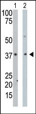 The anti-PDXK Pab (Cat. #AP7079a) is used in Western blot to detect PDXK in mouse intestine tissue lysate (Lane 1) and Hela cell lysate (Lane 2).