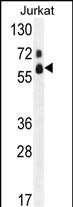 WB - FASTK Antibody (C-term) AP7084b