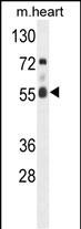 WB - FASTK Antibody (C-term) AP7084b