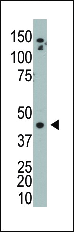 The anti-ADK Pab (Cat. #AP7091a) is used in Western blot to detect ADK in mouse bladder tissue lysate.