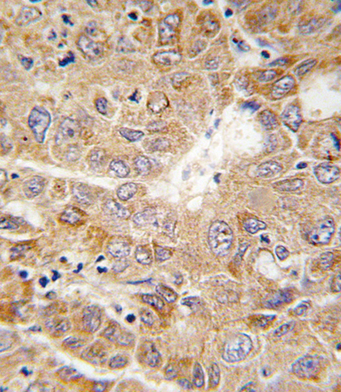 IHC-P - PGK1 Antibody (Center) AP7094b