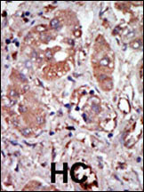 Pkr Prkr Antibody C Term Purified Rabbit Polyclonal Antibody Pab Ihc P Wb E Buy Now Abcepta