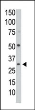 The anti-PPP1CC Pab (Cat. #AP8432a) is used in Western blot to detect PPP1CC in mouse colon tissue lysate.