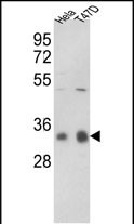 Western blot analysis of hPPP1CC-A306 (Cat. #AP8432b) in Hela, T47D cell line lysates (35ug/lane).PPP1CC (arrow) was detected using the purified Pab.