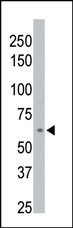 The anti-PPM1D Pab (Cat. #AP8437b) is used in Western blot to detect PPM1D in 293 cell lysate.