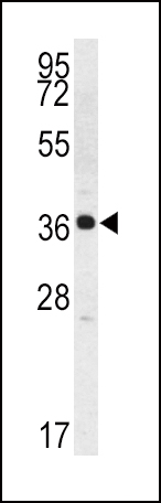 Western blot analysis of Kallikrein 2 (KLK2) Antibody (C-term) (Cat.# AP6321b) in K562 cell line lysates (35ug/lane). KLK2 (arrow) was detected using the purified Pab.
