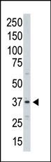 The anti-Aurora-C C-term Pab (Cat. #AP7000c) is used in Western blot to detect Aurora C in A375  cell lysate.