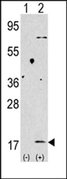 WB - LC3 Antibody (APG8B) (C-term) AP1802b