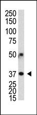 Polyclonal antibody AP1807a was used in Western blot to detect human APG3L in transfected 293 cells.