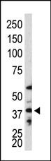 WB - ATG3 Antibody (C-term K183) AP1807c