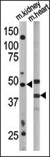 The anti-APG4A Pab (Cat. #AP1808a) is used in Western blot to detect APG4A in mouse kidney (left) and mouse heart (right) tissue lysates