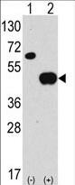 Western blot analysis of anti-hAPG4B-R31 Pab (Cat. #AP1809a) in 293 cell line lysates transiently transfected with the ATG4B gene (2ug/lane). hAPG4B-R31(arrow) was detected using the purified Pab.