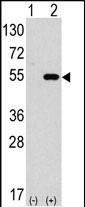 Western blot analysis of anti-hAPG4C-I182 Pab (Cat. #AP1810b) in 293 cell line lysates transiently transfected with the ATG4C gene (2ug/lane). hAPG4C-I182(arrow) was detected using the purified Pab.