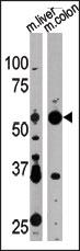 Western blot analysis of anti-APG4D Pab (Cat. #AP1811a) in mouse liver and colon tissue lysate. APG4D (arrow) was detected using the purified Pab.